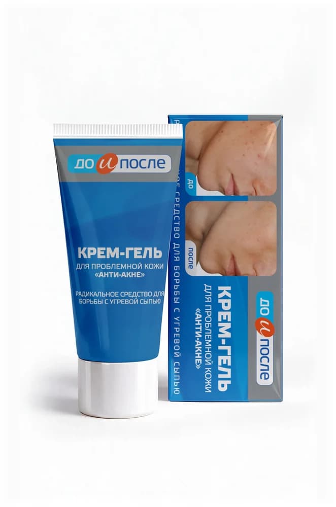 Крем-гель Анти-Акне