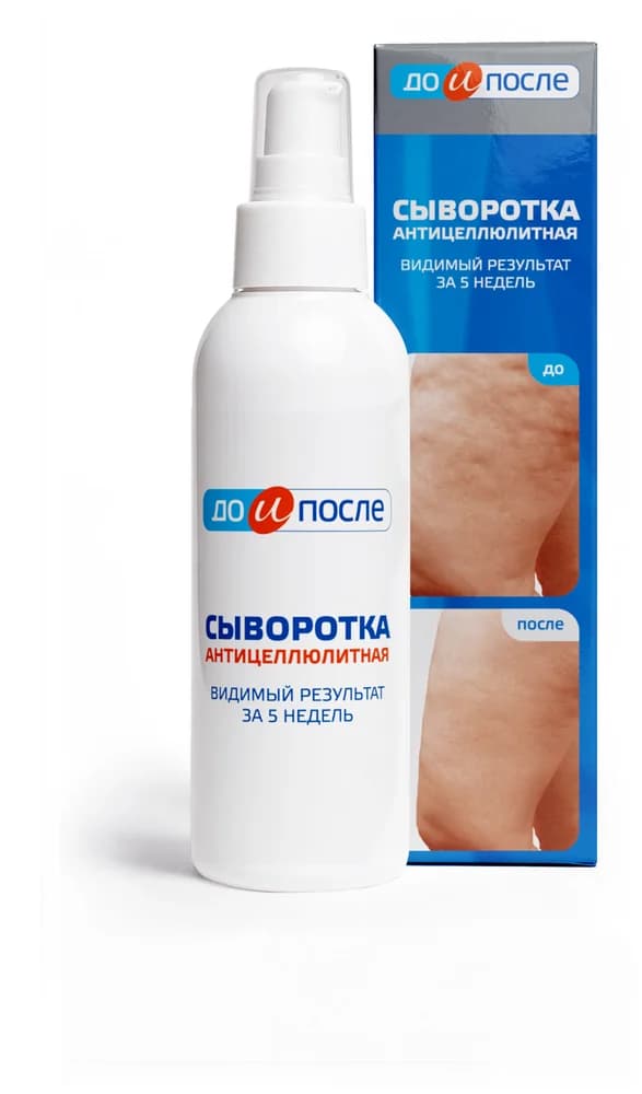 Сыворотка Антицеллюлитная