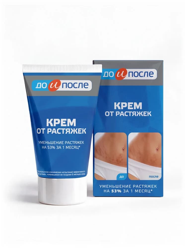 Крем от растяжек